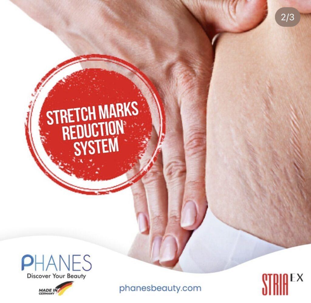stretch marks reduction system, skin cracks reduction system, striaex, phanes beauty germany, mormed,